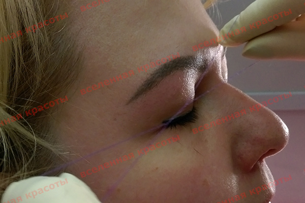 Иллюстрация: на процедуре