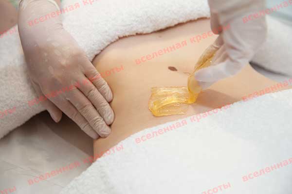 Иллюстрация: на процедуре