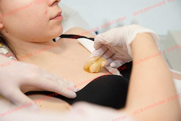 Иллюстрация: на процедуре